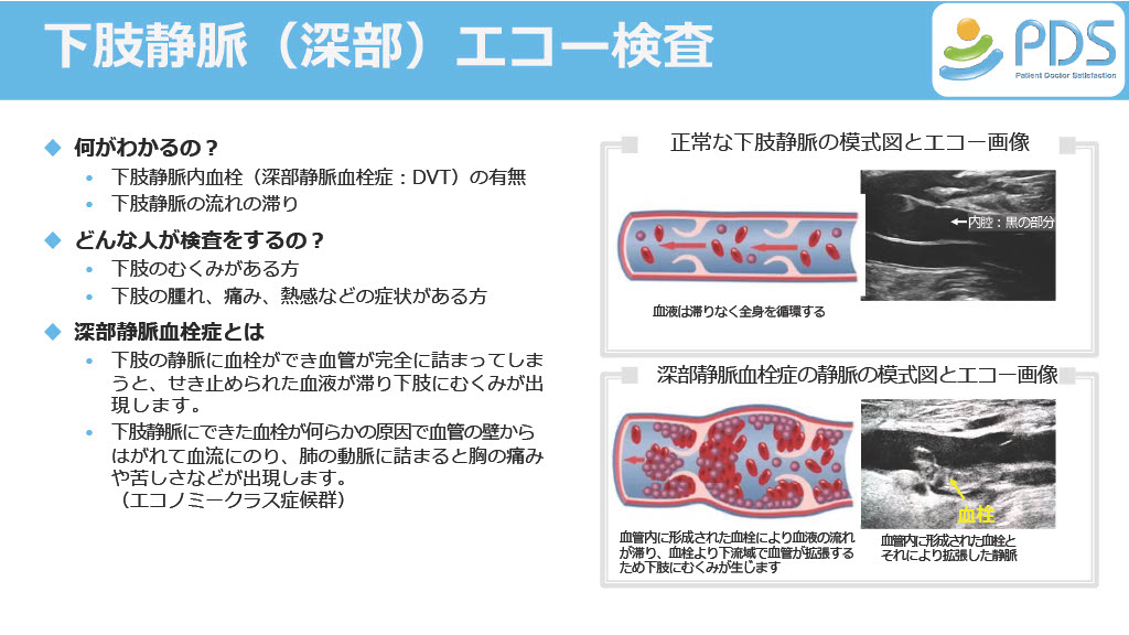 超音波検査のご案内12