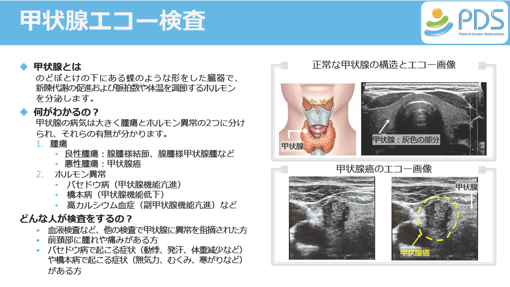 超音波検査のご案内
4