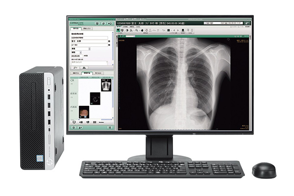デジタル一般撮影装置