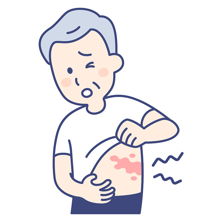 皮疹（蕁麻疹・紅斑・紫斑・丘疹・水疱など）