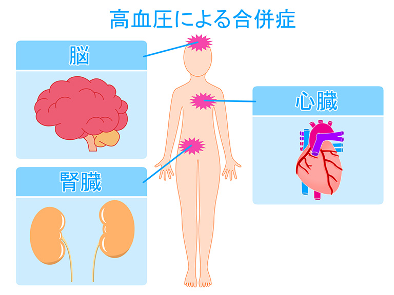 高血圧による合併症